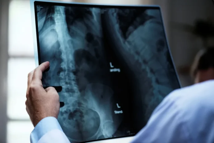 Radiografia de coluna vertebral